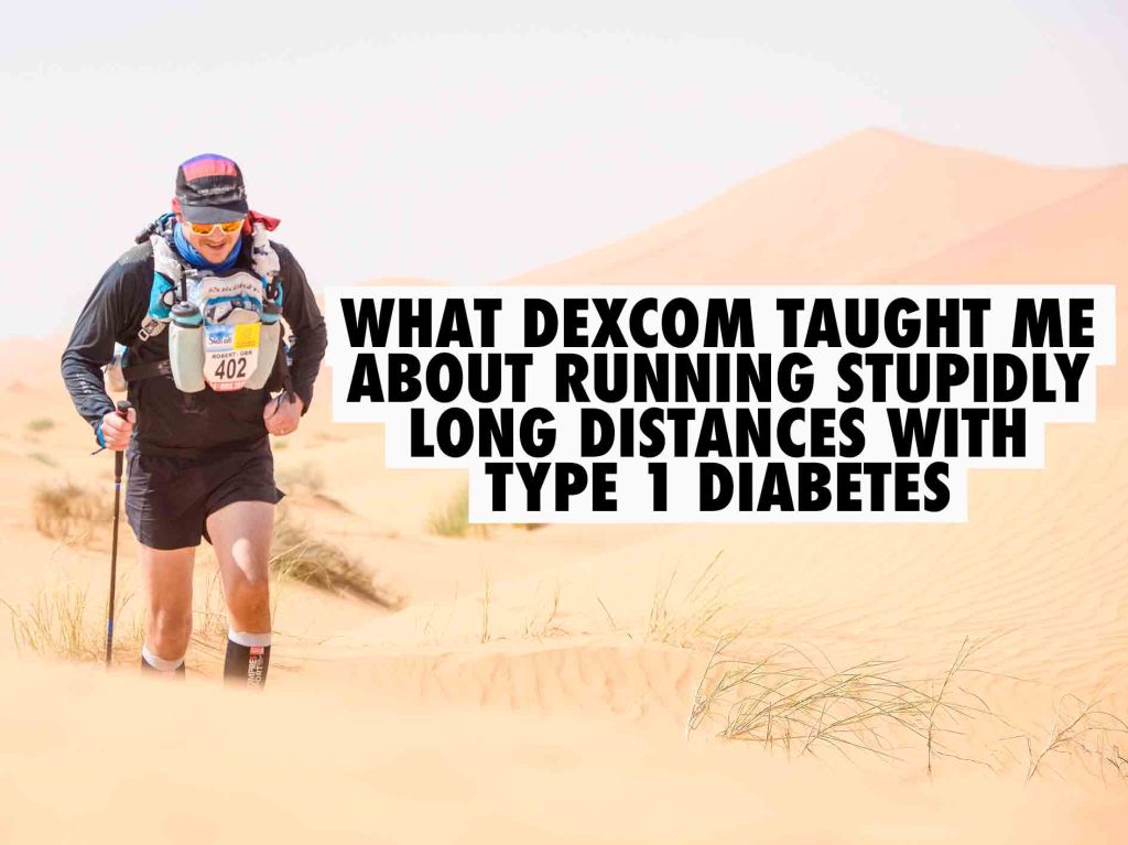 Dexcom lessons